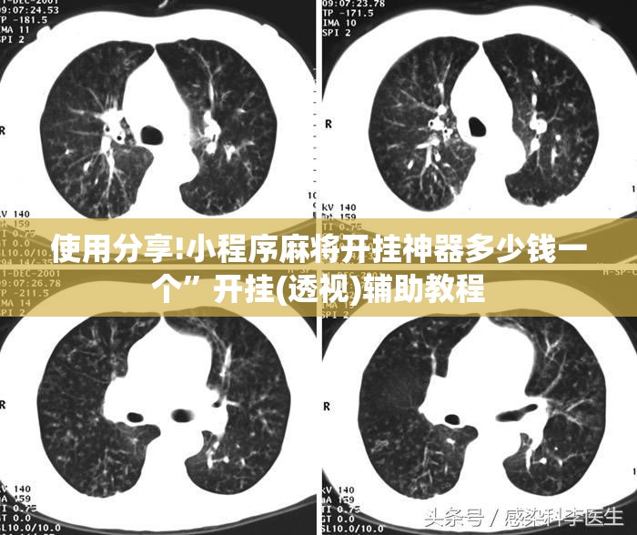 使用分享!小程序麻将开挂神器多少钱一个	”开挂(透视)辅助教程