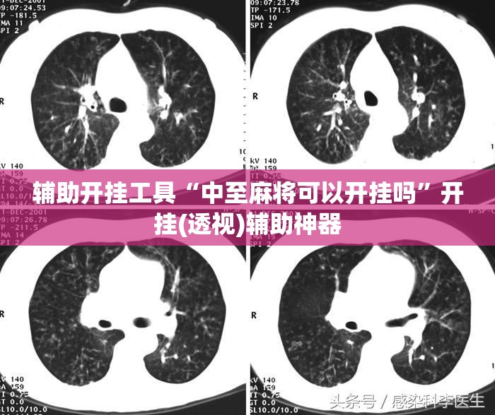 辅助开挂工具“中至麻将可以开挂吗”开挂(透视)辅助神器