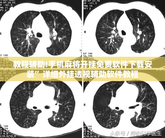教程辅助!手机麻将开挂免费软件下载安装”详细外挂透视辅助软件教程