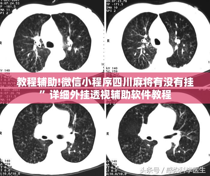 教程辅助!微信小程序四川麻将有没有挂”详细外挂透视辅助软件教程