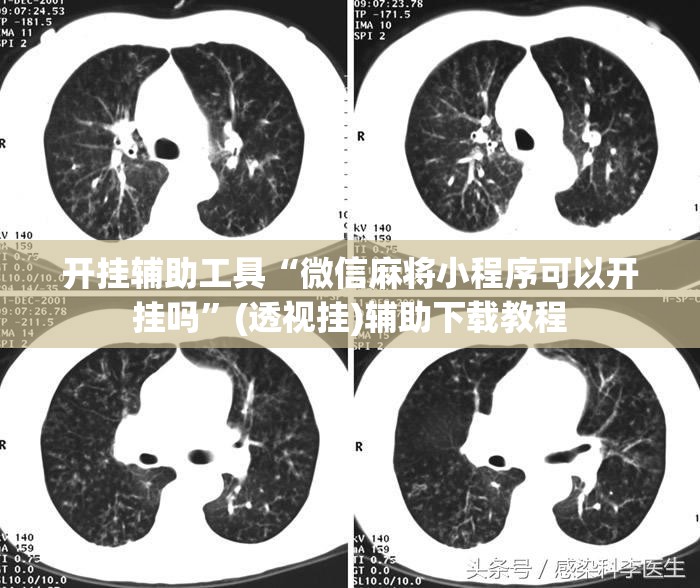 开挂辅助工具“微信麻将小程序可以开挂吗”(透视挂)辅助下载教程