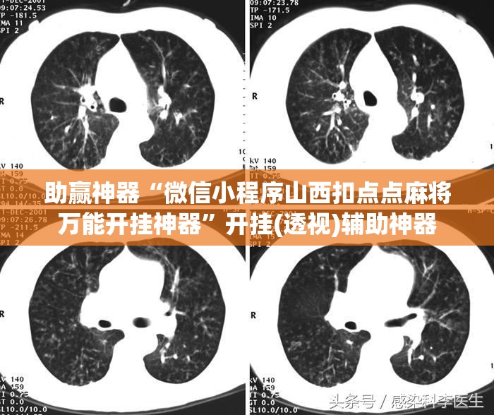 助赢神器“微信小程序山西扣点点麻将万能开挂神器”开挂(透视)辅助神器