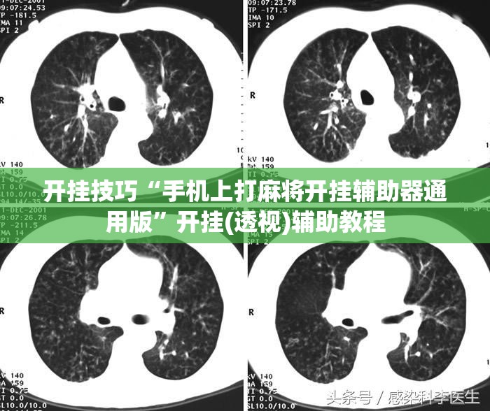 开挂技巧“手机上打麻将开挂辅助器通用版”开挂(透视)辅助教程